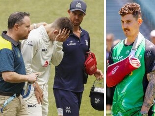 Nic Maddinson is ready to make his Melbourne Stars debut after suffering a broken arm during the Sheffield Shield late last year.