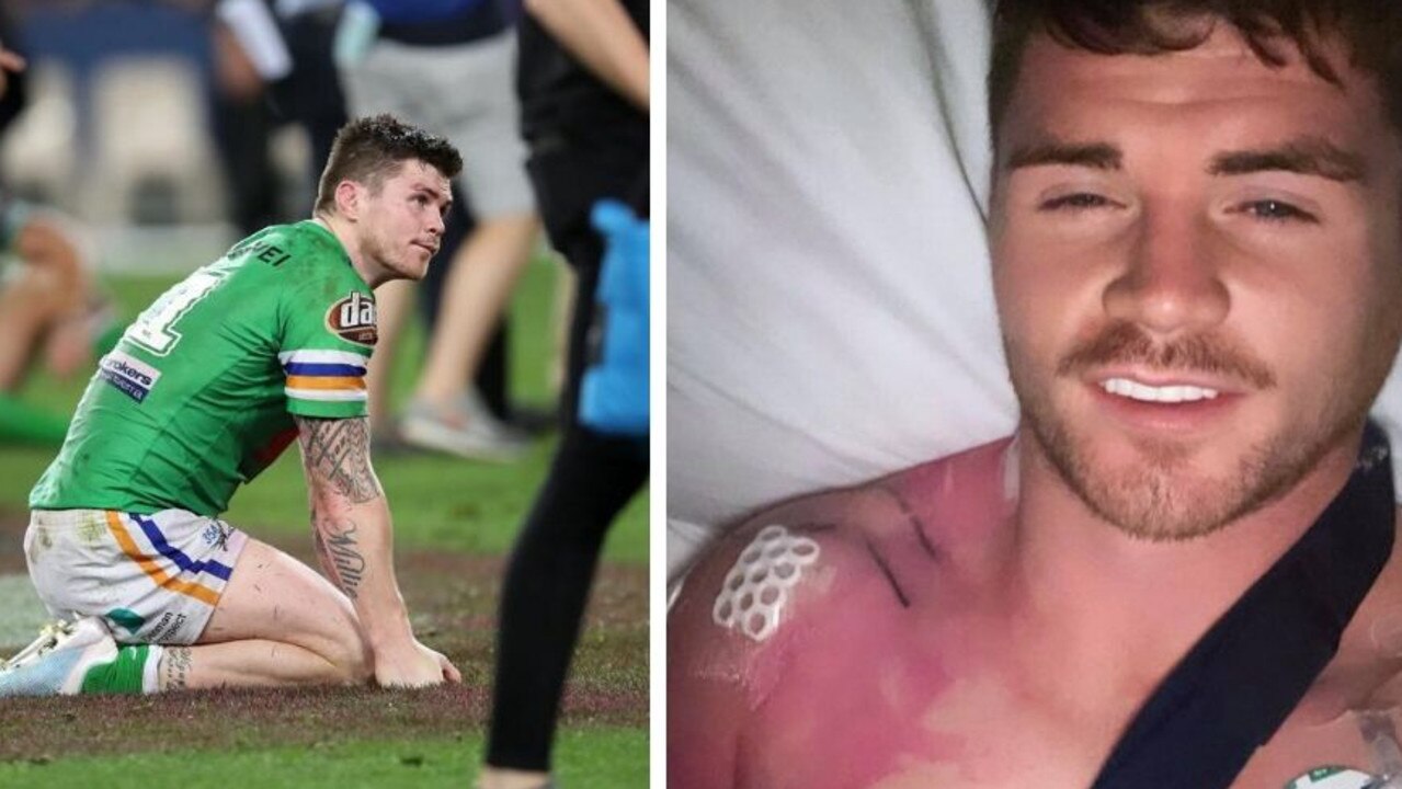 Canberra Raiders star John Bateman is racing the clock to be fit for round one after having shoulder surgery.