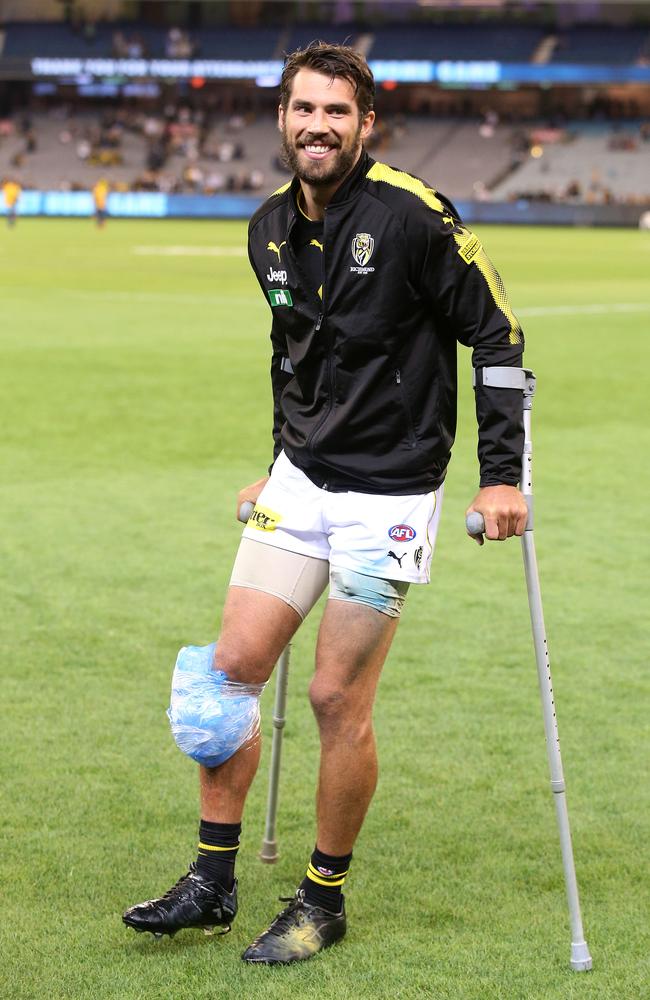 Alex Rance is likely to miss the entirety of 2019. Picture: Michael Klein