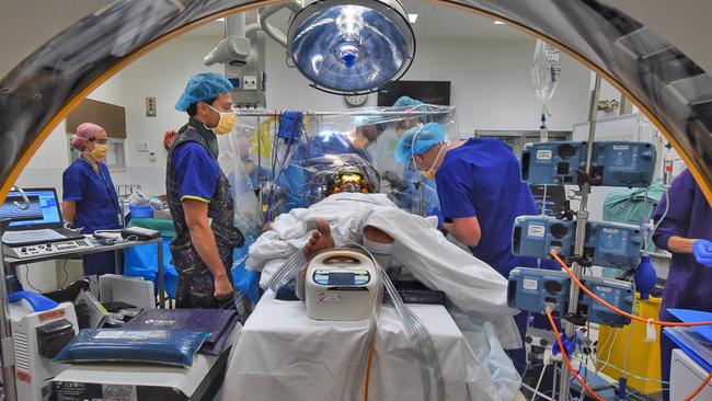 Deep Brain Stimulation is a surgery where electrodes are implanted in the brain to suppress the signals that cause slowness, stiffness and tremor of Parkinson's disease. Picture: Tony Gough