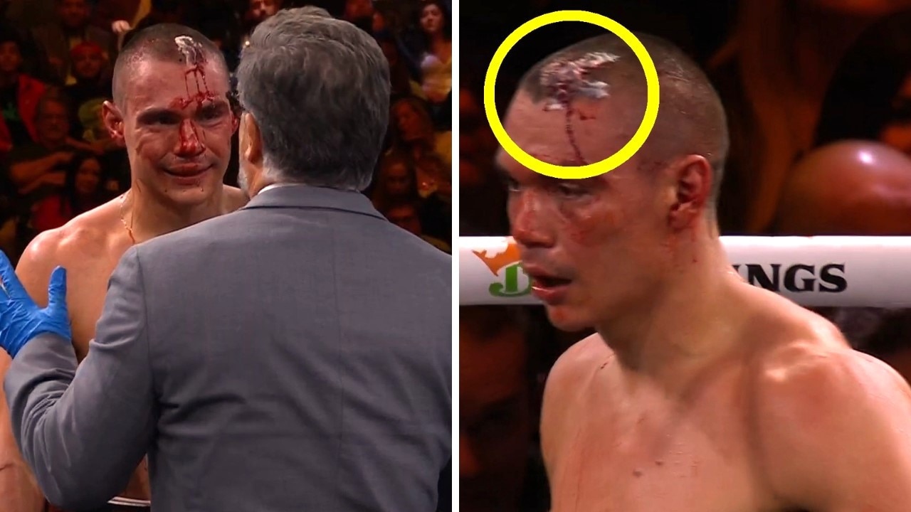 Questions are being asked about the head wound. Photo: Main Event.