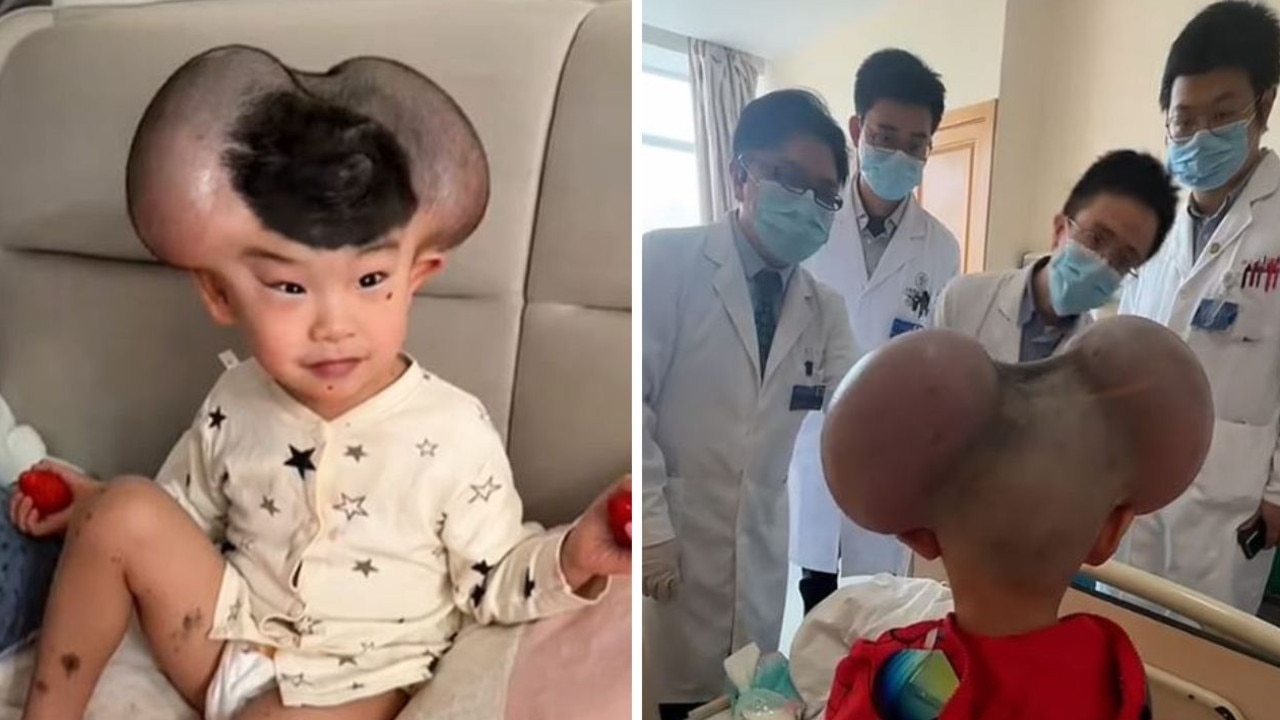 ‘Mickey Mouse’ boy’s wild transformation