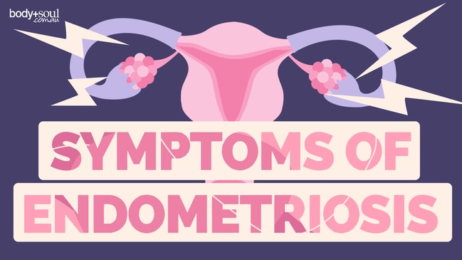 Symptoms of endometriosis