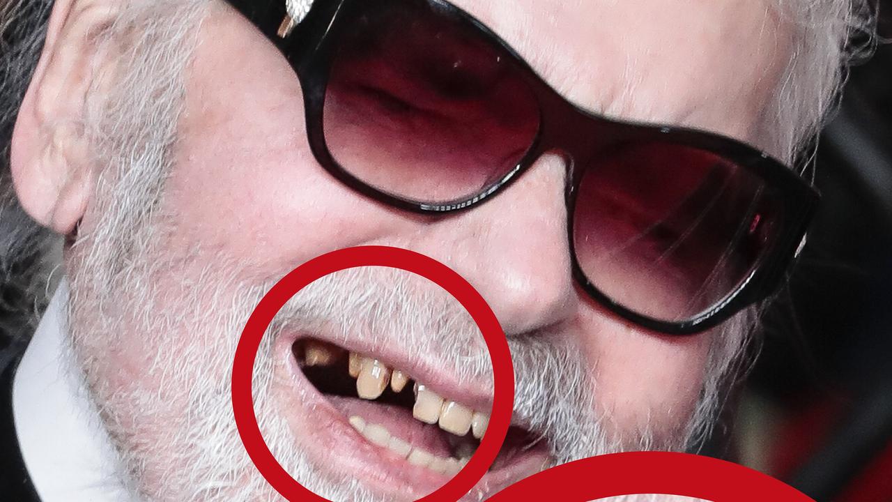 Karl Lagerfeld displays missing teeth as he flashes a broad grin