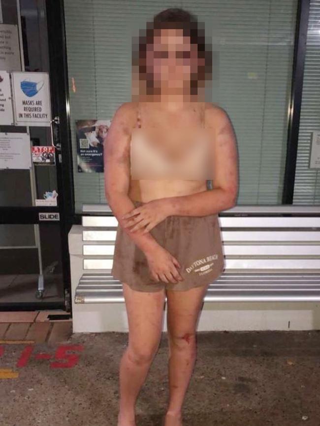 Family of the victim say they ‘couldn’t recognise her’ after the attack. Picture: Instagram.