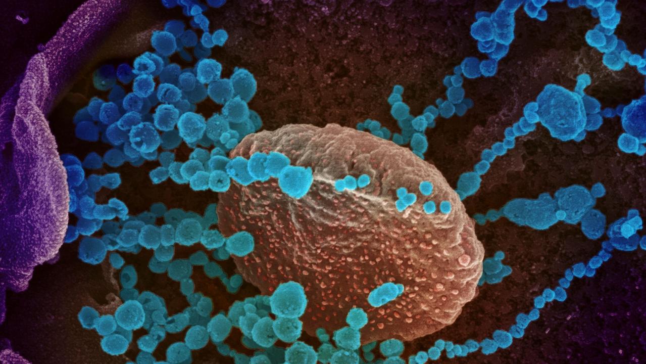 An electron microscope image of SARS-CoV-2 (round blue objects) emerging from the surface of cells cultured in the lab. Picture: AFP