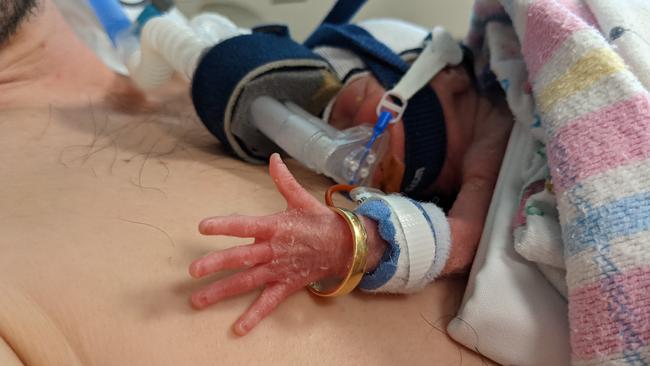 Premature baby Genevieve Olave, an identical twin with her sister Evelyn (Evie), was born at 23 weeks and one day gestation at Mater Hospital in November 2020. Genevieve is pictured wearing her mother Sierra's wedding ring on her arm.