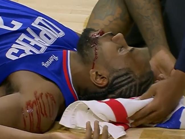 Kawhi Leonard was not in a good way.