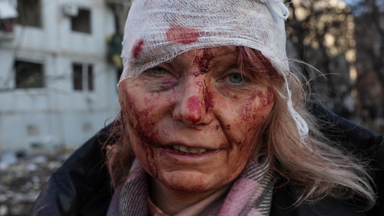 A wounded woman is seen as air strike damages an apartment complex outside of Kharkiv, Ukraine. Picture: Wolfgang Schwan/Anadolu Agency via Getty Images