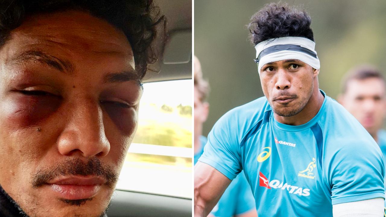 Lopeti Timani has revealed the emotional toll on him after he was bashed by his then teammate Amanaki Mafi in 2018.