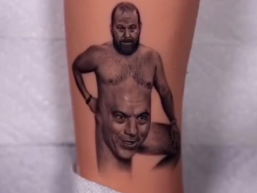 joe rogan vitiligo