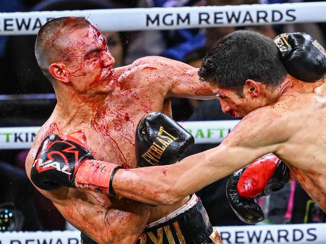 Tszyu was nearly blinded by the blood gushing from his head wound against Fundora. Picture: Getty