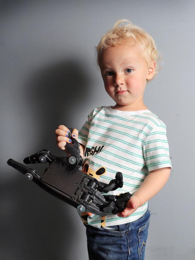 A 3D printed hand prosthesis will help kids like Harlow Bowden. Picture: Alex Coppel