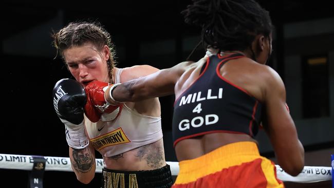 Harris said the injury didn’t hurt, despite the massive swelling on her cheek, and is confident she will be fine for the start of the AFLW season. Picture: Getty Images.