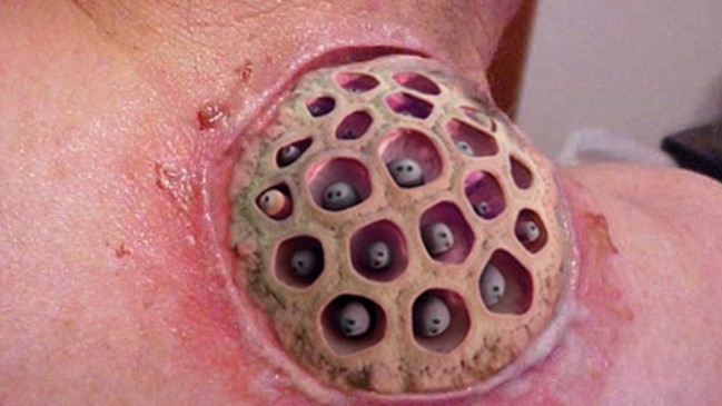 lotus seed pod photoshop on body