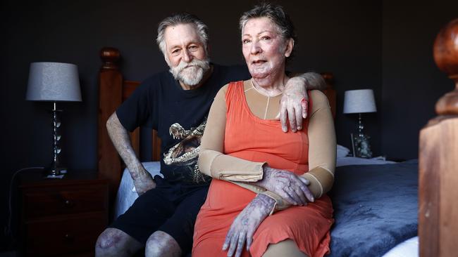 Alex and June Frew back home at Bendalong after suffering horrific burns in the summer bushfires. Picture: Sam Ruttyn