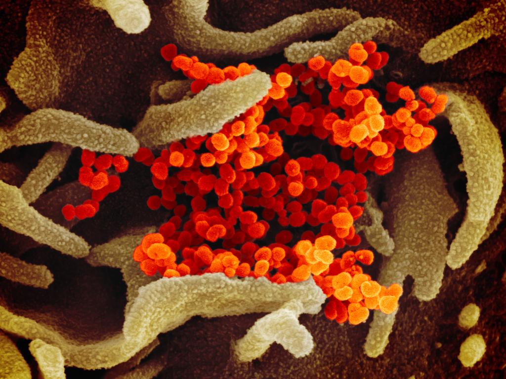 This image shows the deadly COVID-19 invading a patient’s cells. Picture: NIAID