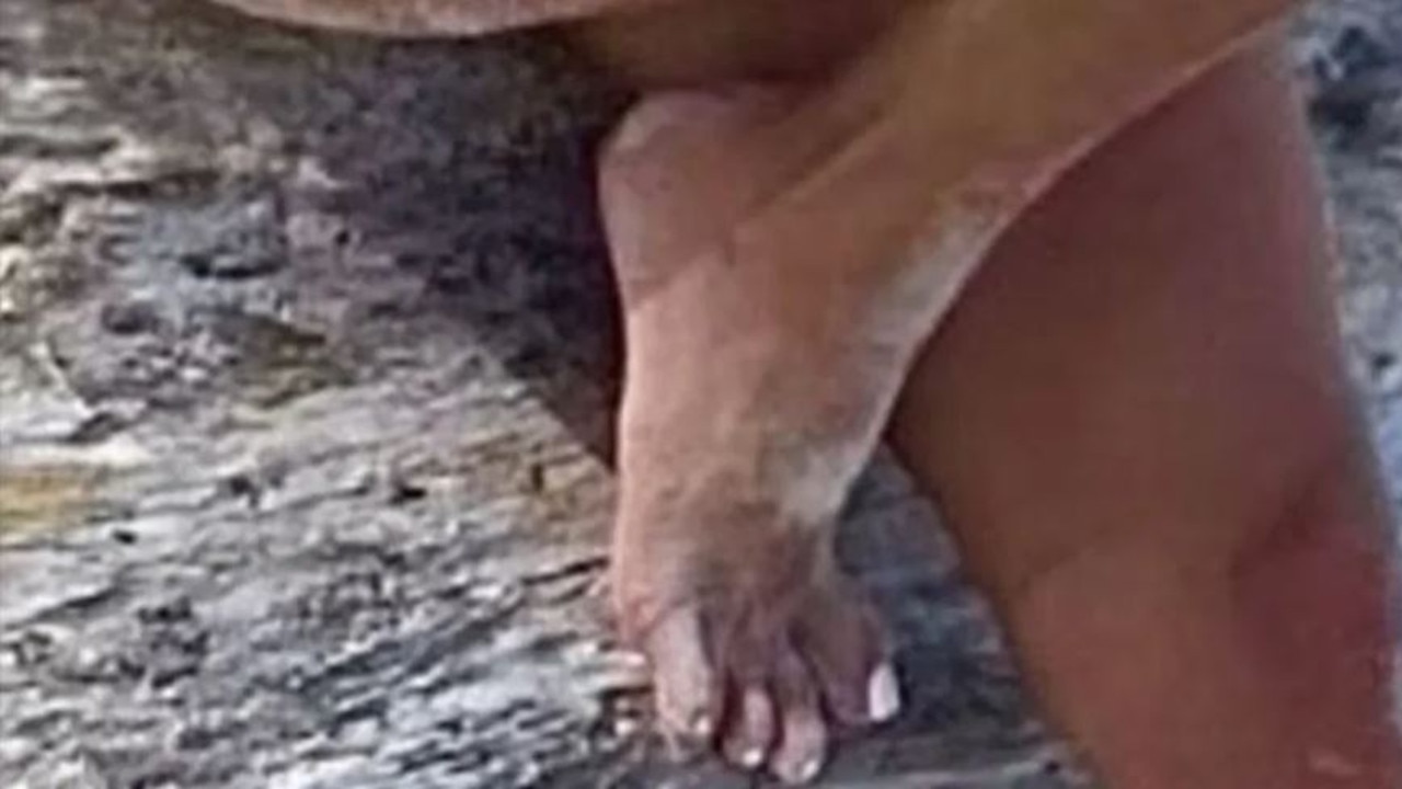 Kim was accused of having four toes on her left foot.