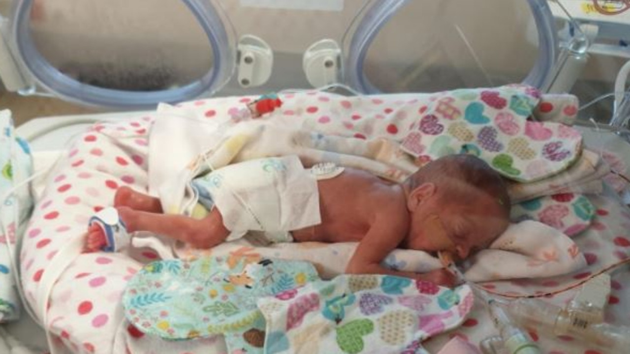 Baby Moira weighed just over 500g when born at just 23 weeks. Picture: Ashlee Eager