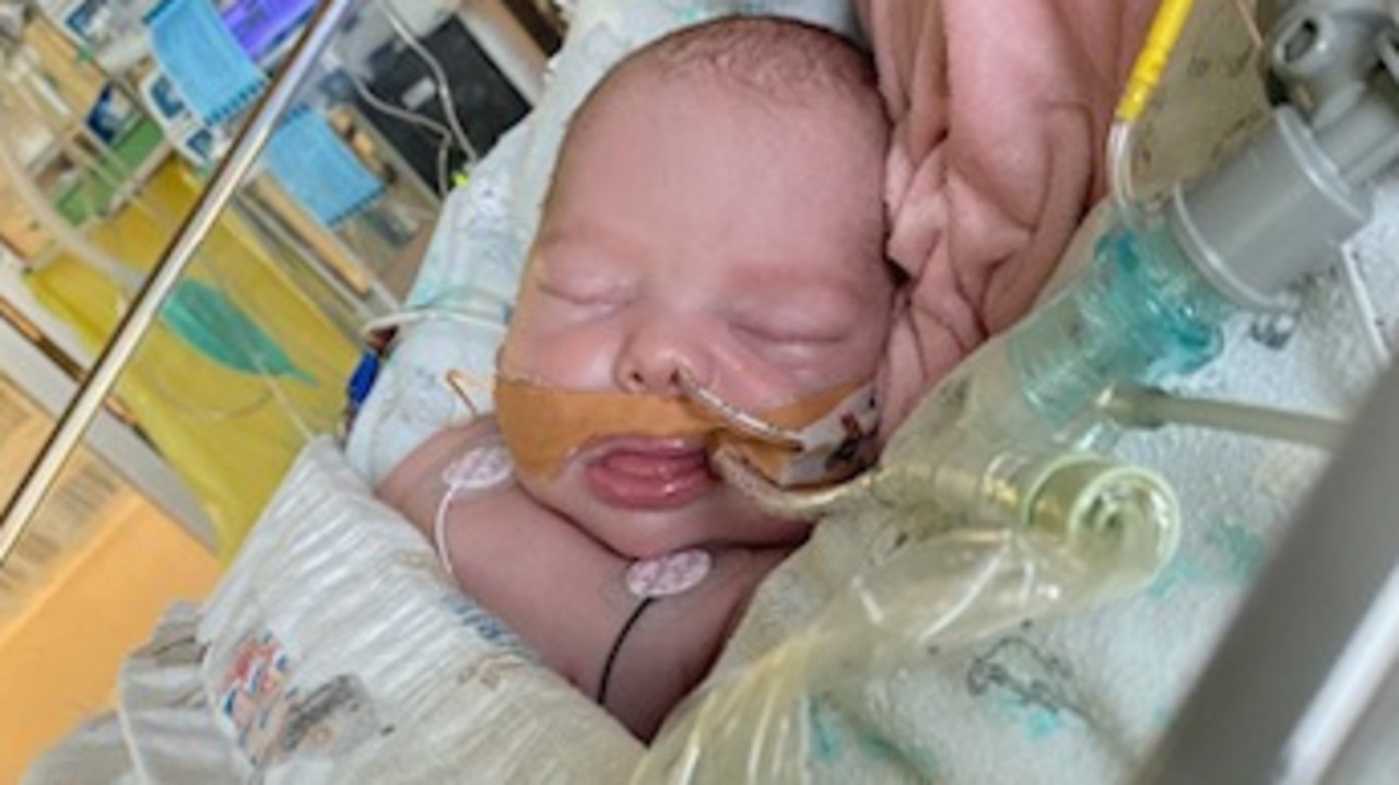 Mildura baby Pixie Doecke suffering from myocarditis, rhinovirus and