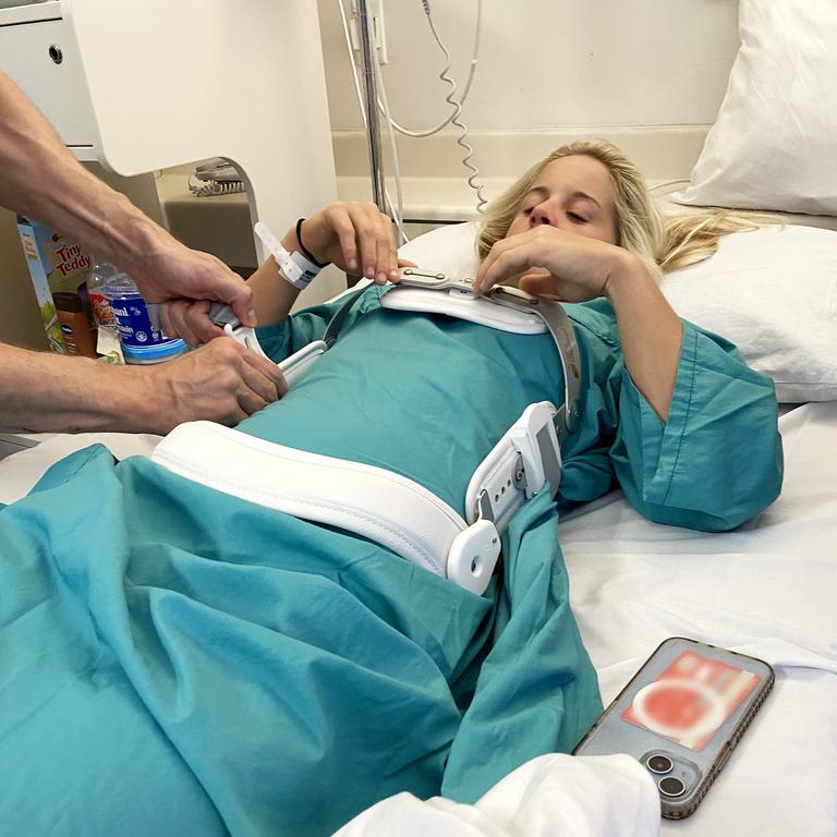 Surfer Sophie McCulloch in hospital with a broken back after a surf accident.