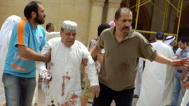 An injured man is helped following the blast at the mosque in Kuwait.