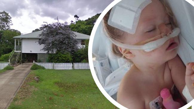 Athena Blackburn, 3, suffered a horrible fall from a second-storey window at Casino in the Northern Rivers. Pictures: Supplied