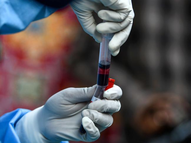 A health worker transfers in a test tube a blood sample donated by a recovered COVID-19 coronavirus patient for plasma at a donation camp in Srinagar on July 22, 2020. (Photo by TAUSEEF MUSTAFA / AFP)