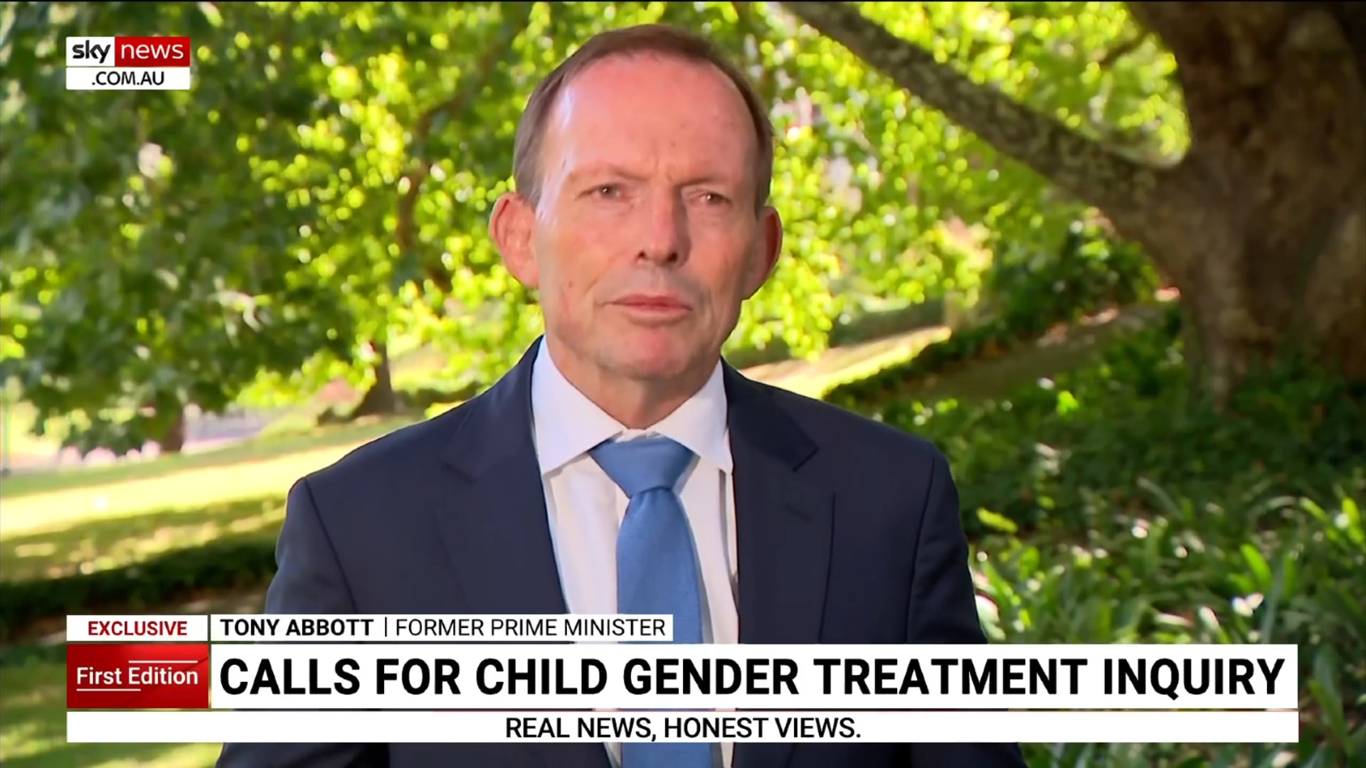 Calls for inquiry into gender treatment for children