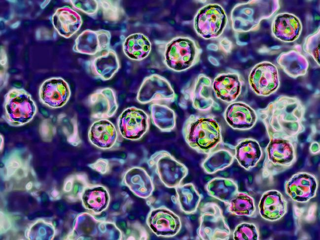 The measles virus, paramyxoviridae from the Morbillivirus family, transmission microscopy view. (Photo by: BSIP/Universal Images Group via Getty Images)