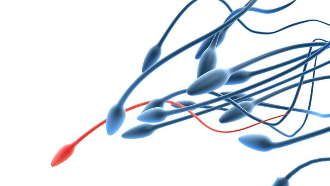 The study found “a 50 to 60 per cent decline” in sperm count among men from North America, Europe, Australia and New Zealand.