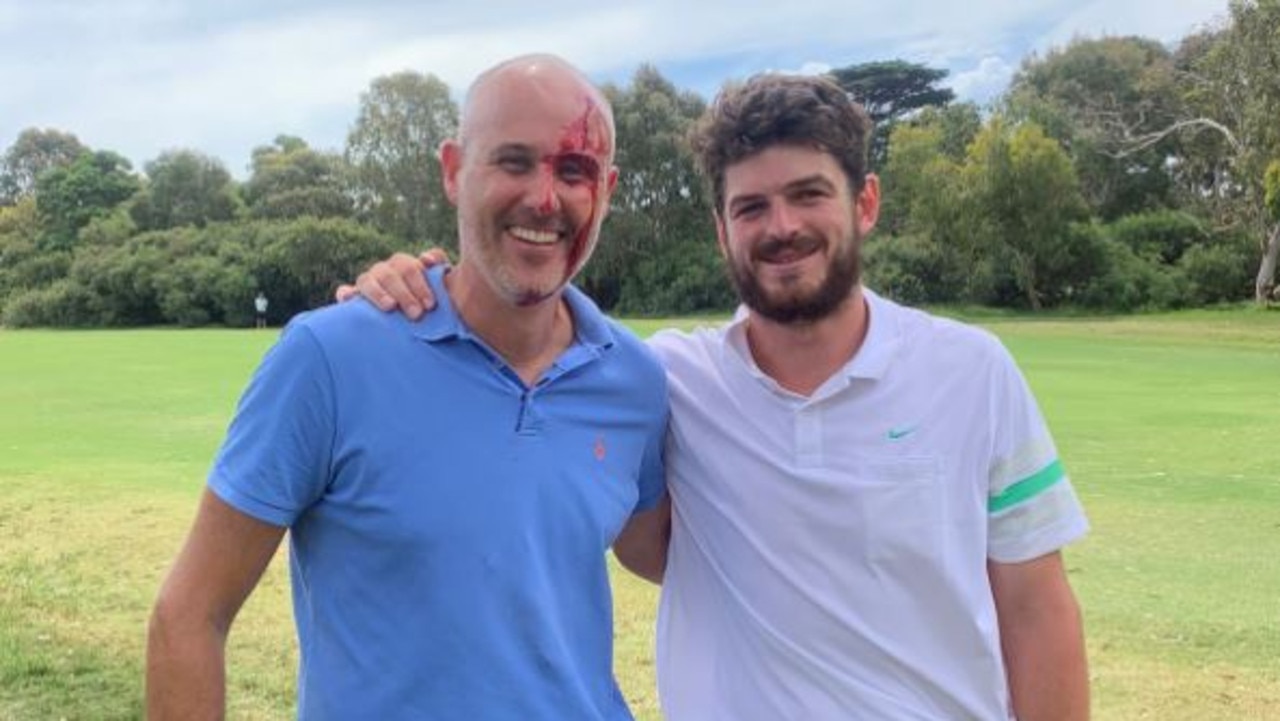 Angus Brayshaw and the golfer he struck at Royal Melbourne GC. Photo: 3AW