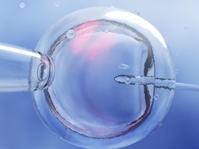 IVF (in vitro fertilisation) or insemination of a female egg under the microscope.