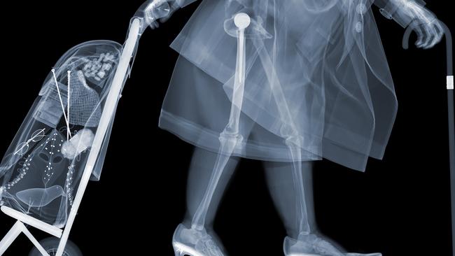 Artist Nick Veasey exposes what X-rays can really see news.au — Australias leading news site
