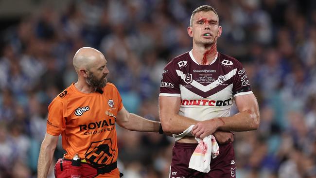 SYDNEY, AUSTRALIA - AUGUST 30:  Tom Trbojevic of the Sea Eagles is assisted by a trainer after an injury and a head cut during the round 26 NRL match between Canterbury Bulldogs and Manly Sea Eagles at Accor Stadium on August 30, 2024, in Sydney, Australia. (Photo by Cameron Spencer/Getty Images)