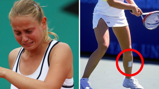 Australian tennis great Jelena Dokic has posted a set of images to Instagram, revealing the horrific personal aftermath of what is a global issue.