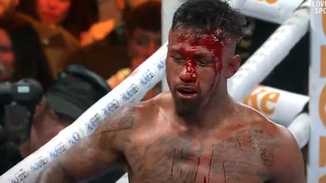 Blood was streaming from Hunter Ioane’s face. Photo: Fox Sports.