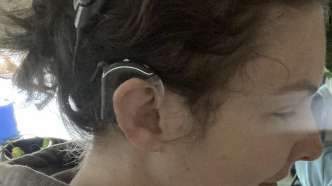 Launceston cochlear implant recipient Jae Denney, who has become a provisional audiologist with Hearing Australia to help other people with deafness. Picture: Supplied