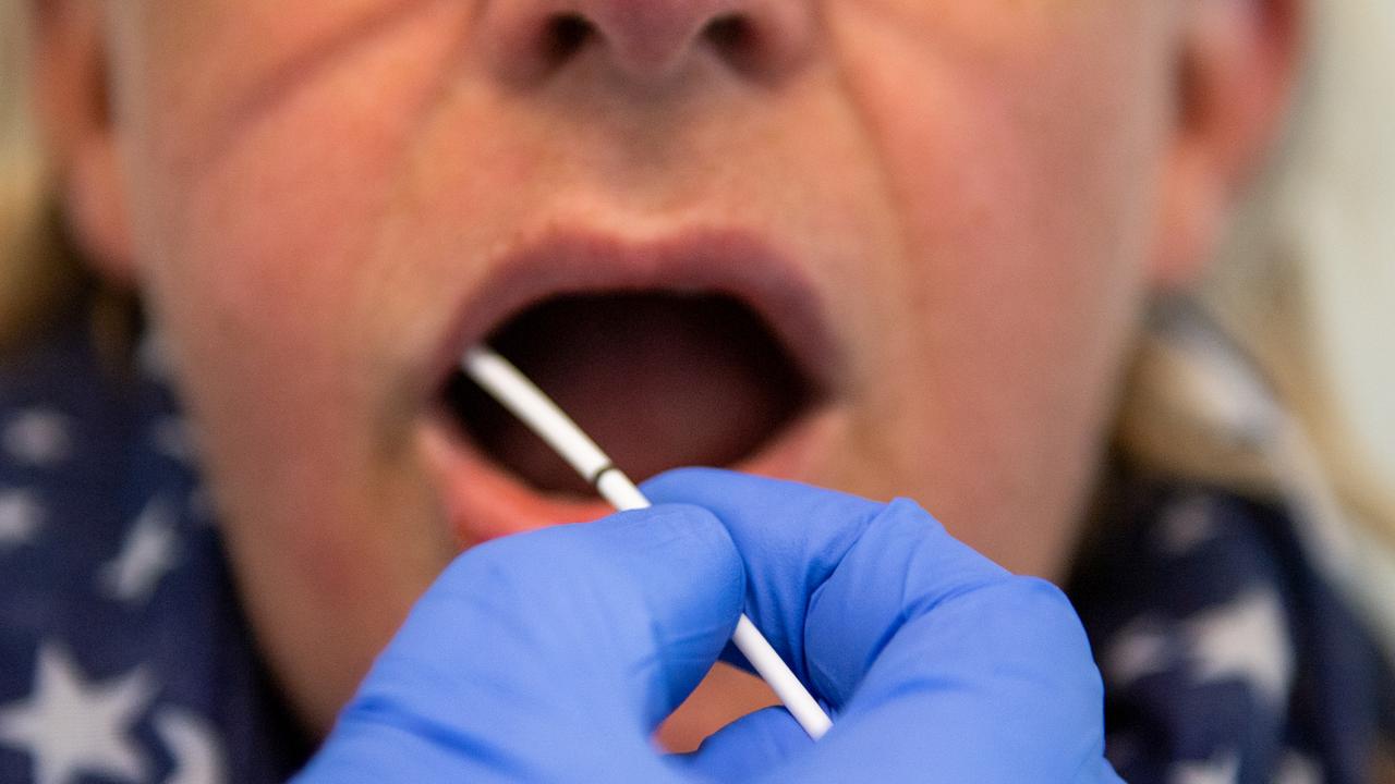 A doctor takes a throat swab sample from a patient for coronavirus testing. Picture David Hecker/Getty Images)