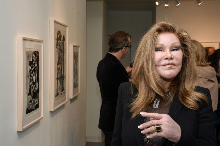 Jocelyne Wildenstein, Socialite and Cosmetic Surgery Icon, Passes Away at 79