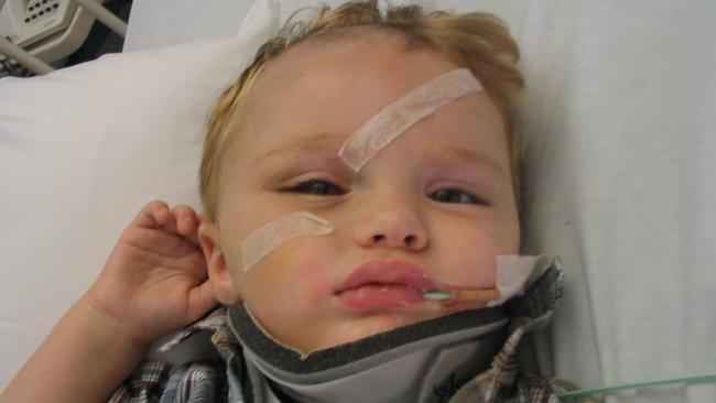 Layton Smith in 2004, then two years old, recovering in hospital after being hit in a car crash that is now the subject of a NSW Supreme Court appeal. Picture: Supplied