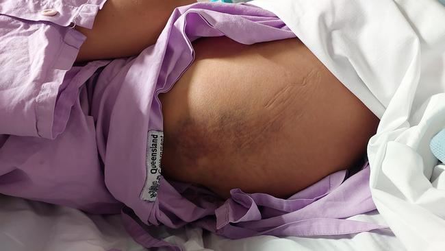 Injuries sustained by Mitchell Barry Sullivan's drink-driving victim. Picture: Supplied