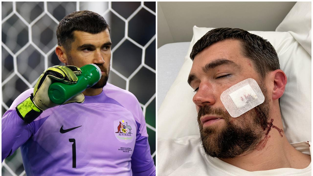 Maty Ryan is in doubt for the Asian Cup after a cheekbone fracture.