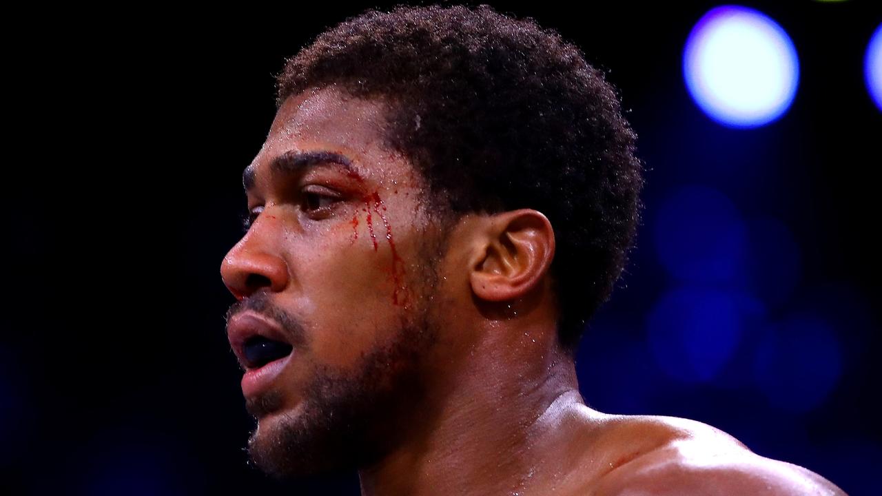 Could Anthony Joshua be skipped over?
