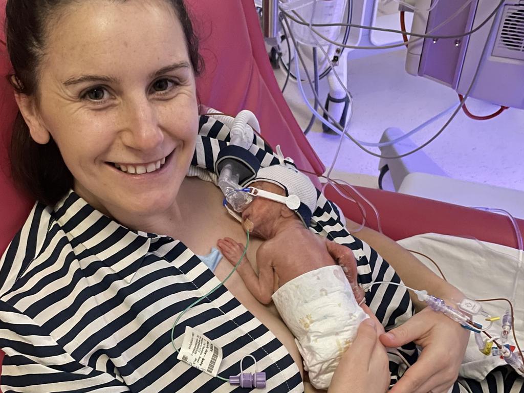 Sarah Kirby holds her son Teddy who weighed just 719 grams at birth at The Women’s and could almost fit in the palm of her hand.