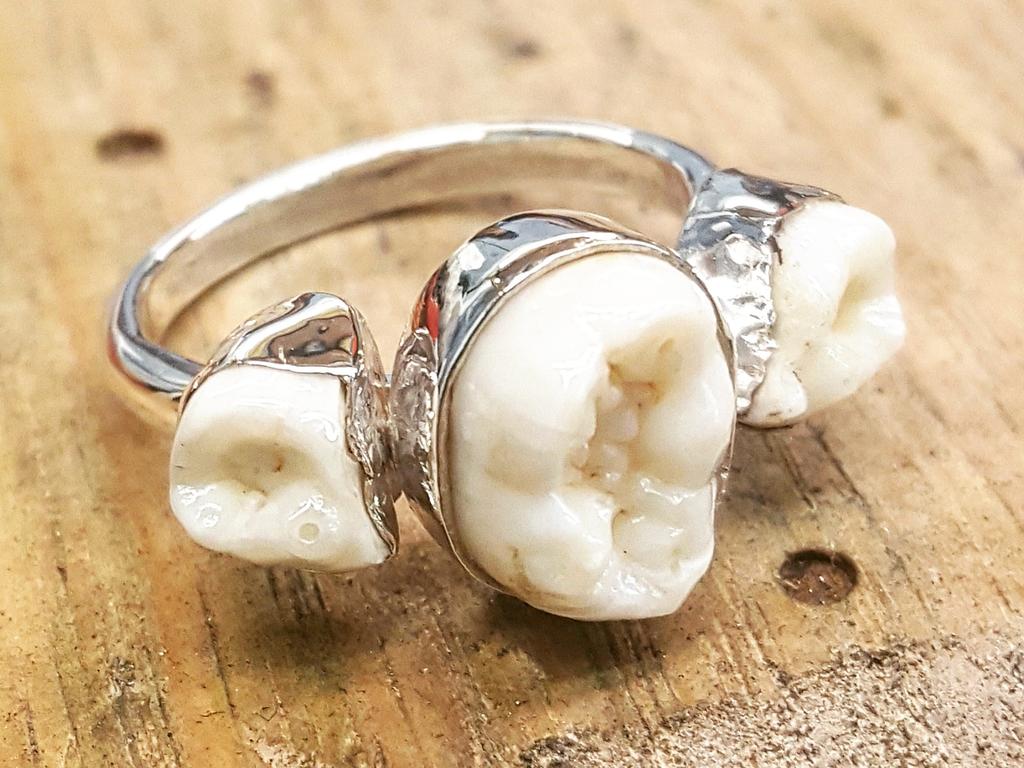 Rings for teeth sale