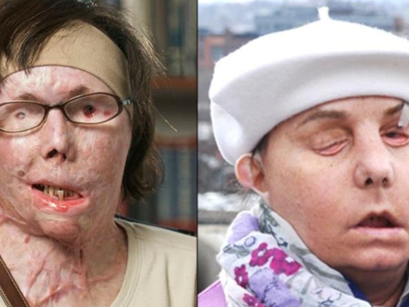 The nurse was left incredibly disfigured. Picture: NBC