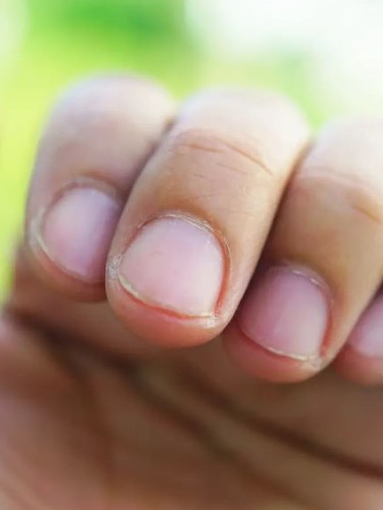 Nails are primarily composed of the protein keratin, so it’s crucial to eat plenty of protein to keep nails healthy and strong. Picture: NY Post.