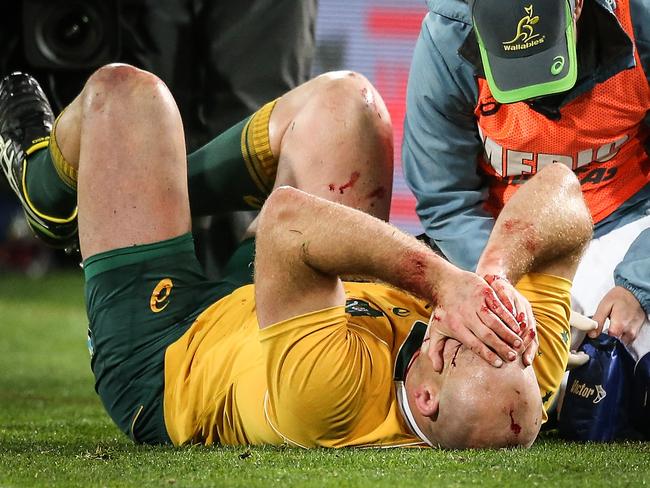 Ouch. Stephen Moore copped a boot to the face.