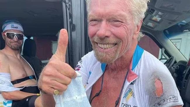 Sir Richard Branson's injuries from his recent bike crash. Picture: Instagram